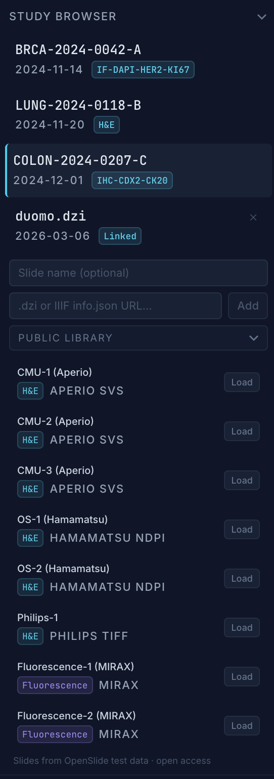 Study Browser panel showing slide list and URL input