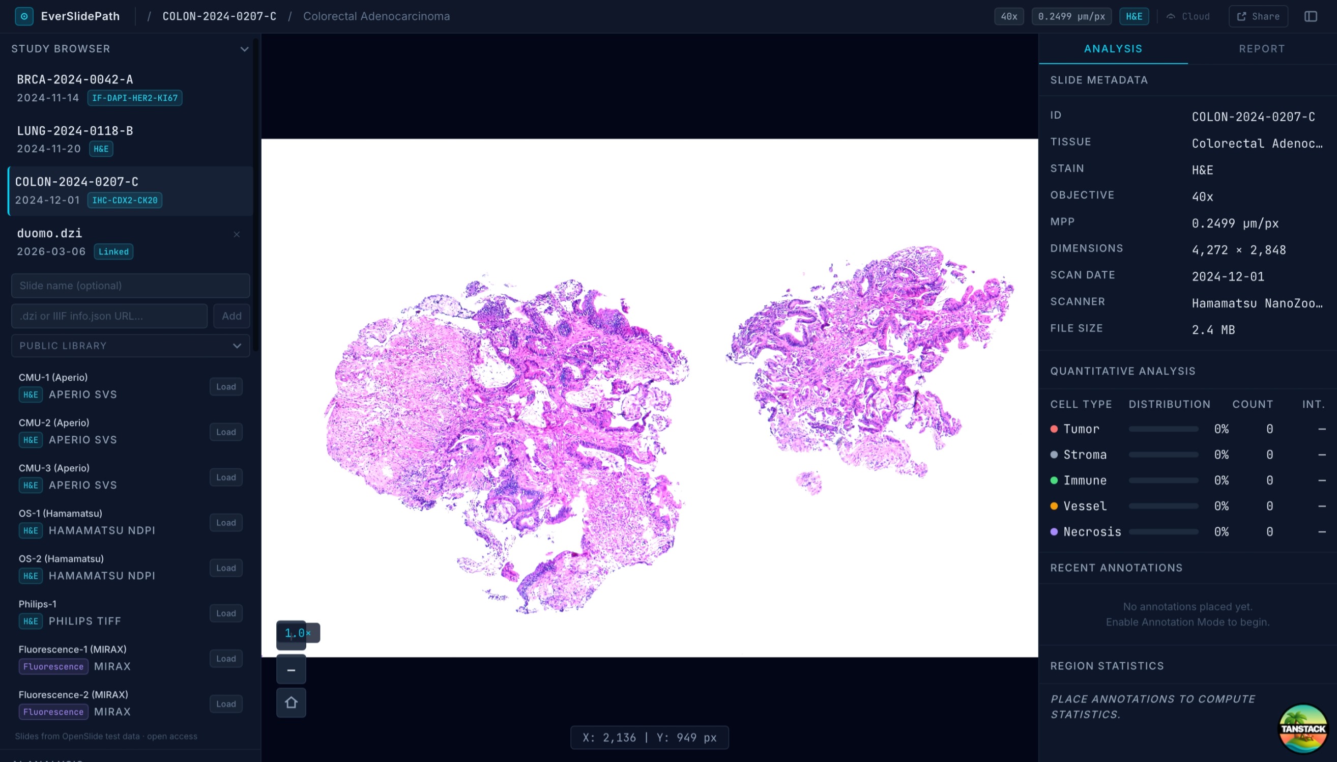 Full viewer showing all four UI zones: TopBar, Left Sidebar, WSI Canvas, Right Sidebar